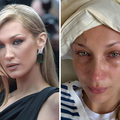 Bella Hadid zabrinula fanove fotkama iz bolničkog kreveta, bori se s teškom bolešću...