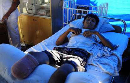 Indonezija: Sam si odrezao nogu pilom da spasi život
