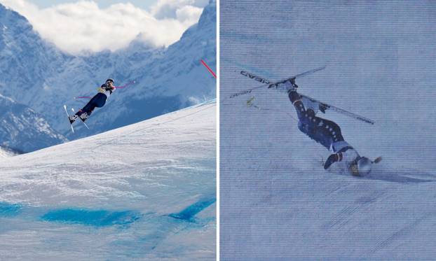 FOTO Ni sa štakama ne skriva seksepil. Lindsey Vonn blista tri mjeseca nakon stravičnog pada