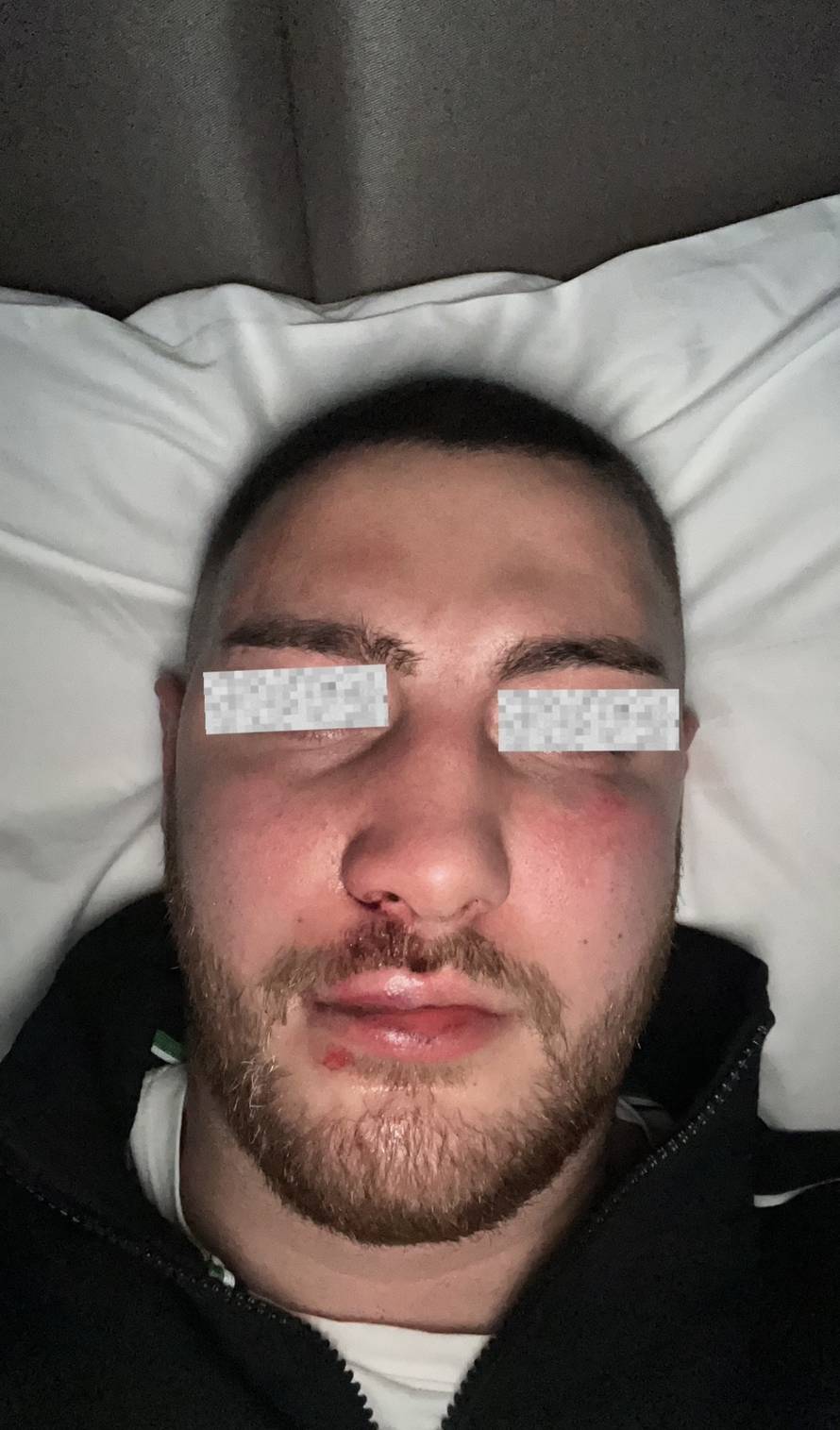 UŽAS U BEOGRADU Pretukli Hrvate u novogodišnjoj noći: 'U Zemunu su mi krivo zašili jezik'