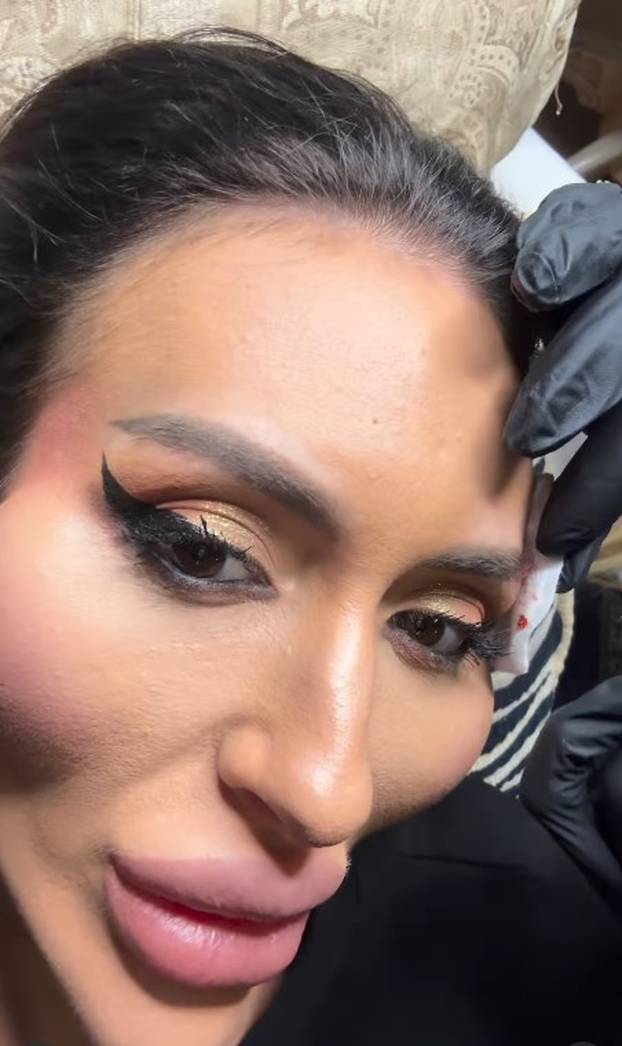 Žena s 'najvećim obrazima na svijetu' objavila fotografiju iz mladosti: 'Šok! Šteta ljepote'