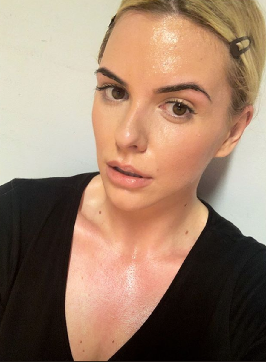 Nina Martina: 'I ja imam višak kože, samo ga dobro upakiram'