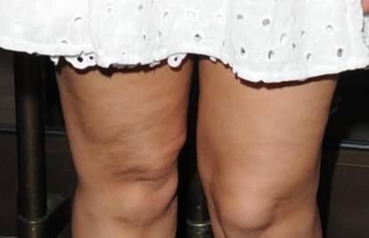 Amelle Berrabah pokazala krive noge pune celulita