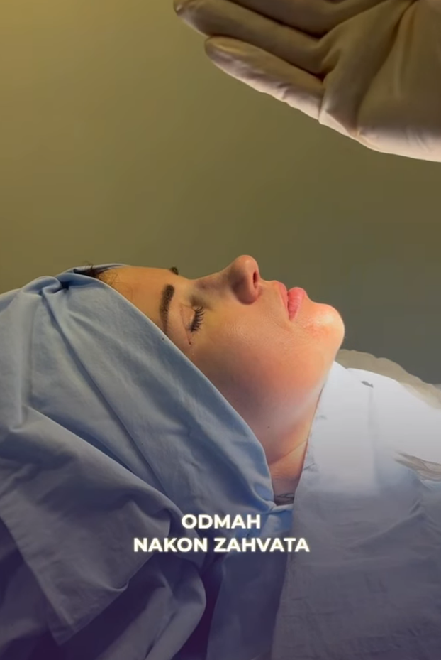 FOTO Sestra Stele Rade išla na estetske zahvate: Pokazala je rezultate, evo kako izgleda...