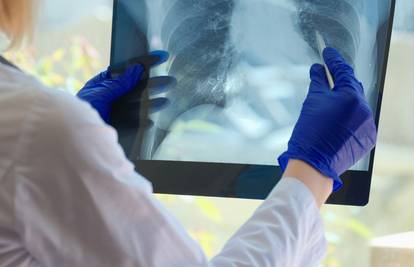 Ova bolest svake minute ubije dva čovjeka!  Po broju umrlih nadmašila je i koronavirus