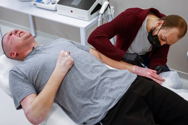 Former Ukrainian serviceman, who was wounded at a front line, comes to a clinic to treat scars, in Kyiv