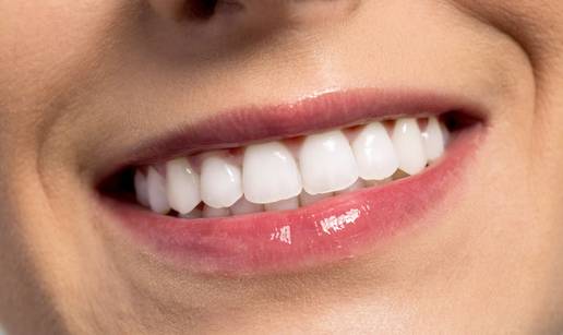 Znate li &scaron;to je oil pulling i za&scaron;to je odli&ccaron;an za oralno zdravlje?