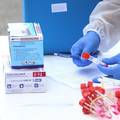 Testira se eksperimentalni lijek za sprječavanje krvnih ugrušaka prilikom zaraze korona virusom
