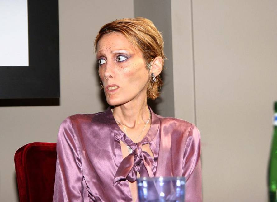 Emmevi Photo/Pixsell