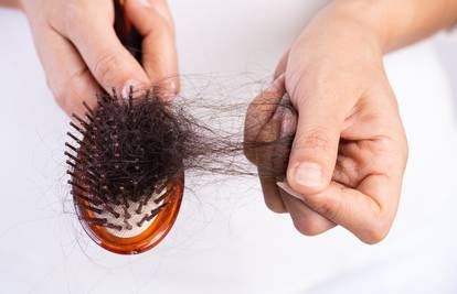 Najbolje metode za pranje četki za kosu: Evo što vam sve treba