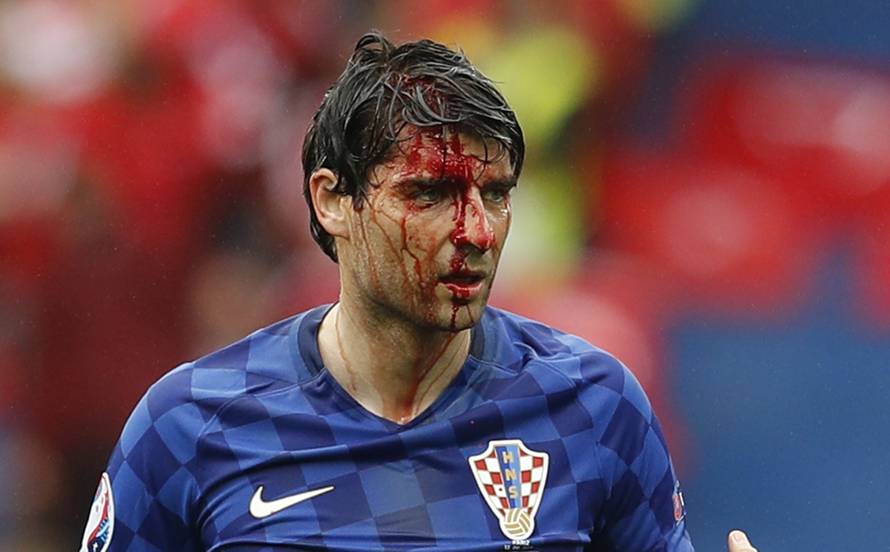 Turkey v Croatia - EURO 2016 - Group D