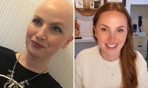 Liječnica koja je preboljela rak 3. stadija: 'Ovo su dvije namirnice biste trebali jesti'