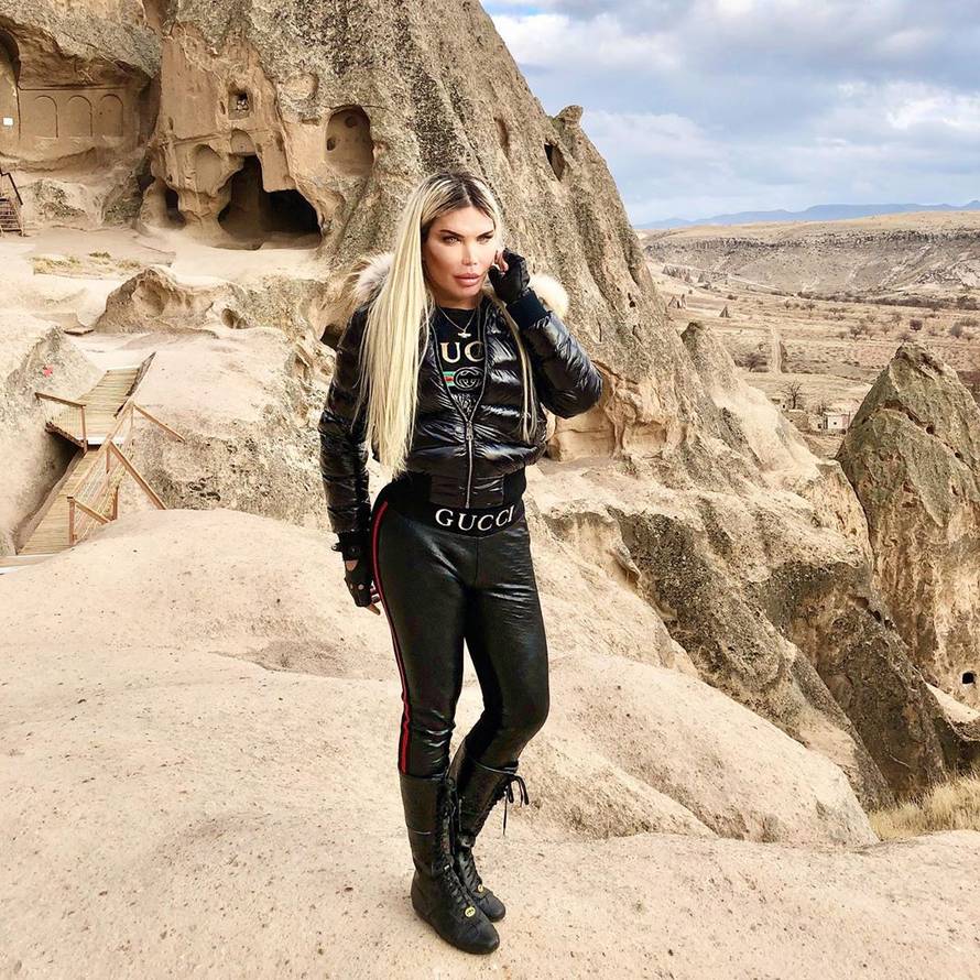 Ljudski Ken je postao Barbie: Ugradio izblajhane ekstenzije