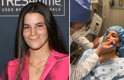 Pit bull joj je odgrizao usnu, a nakon 7 operacija manekenka ponosno pokazala novi osmijeh