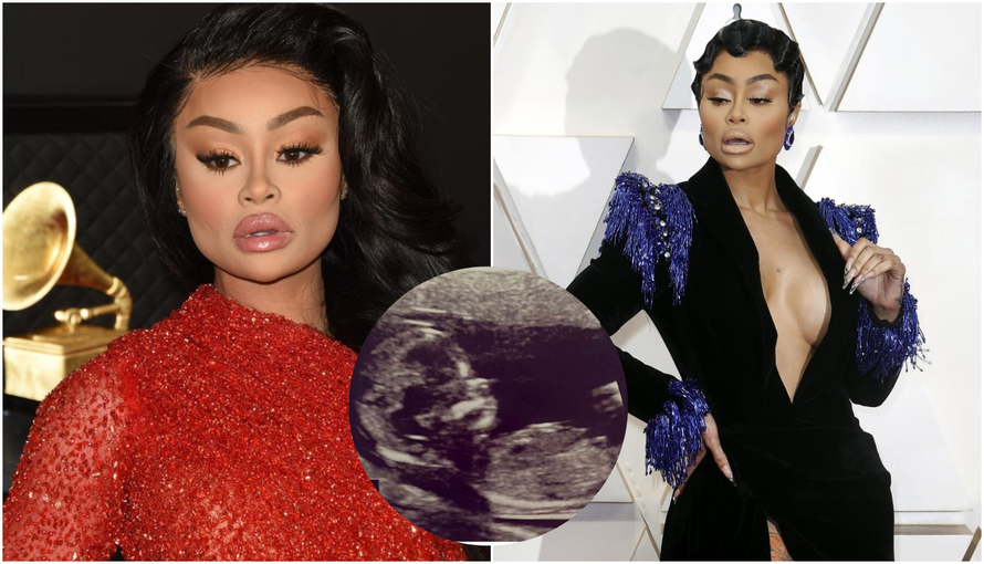 Blac Chyna je ponovno trudna, a pratitelji se pitaju tko je otac