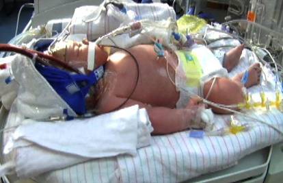 Maleno čudo: Beba je bez zraka preživjela 20 minuta