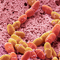 Šestero djece u Britaniji umrlo od infekcije bakterijom Strep A
