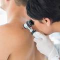 Češće i umiru: Karcinom kože dvaput češće pogađa muškarce