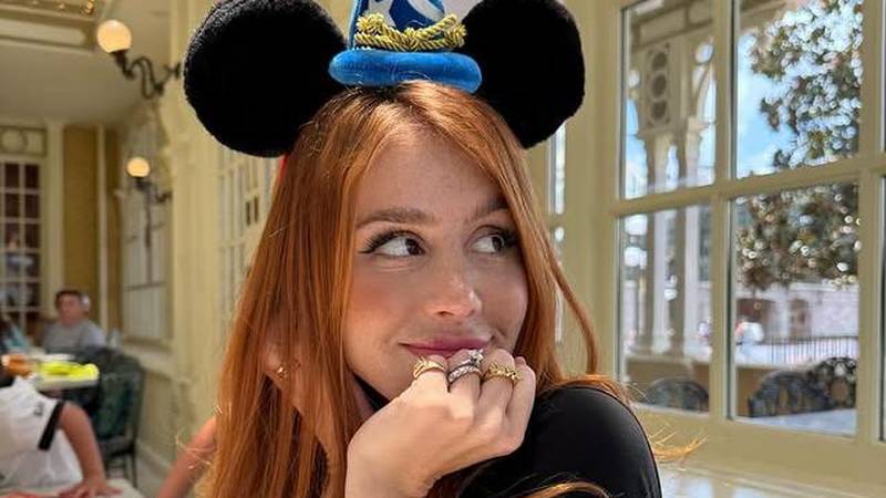 FOTO Posebna ljepota: Milijuni ljudi obožavaju njezine pjegice