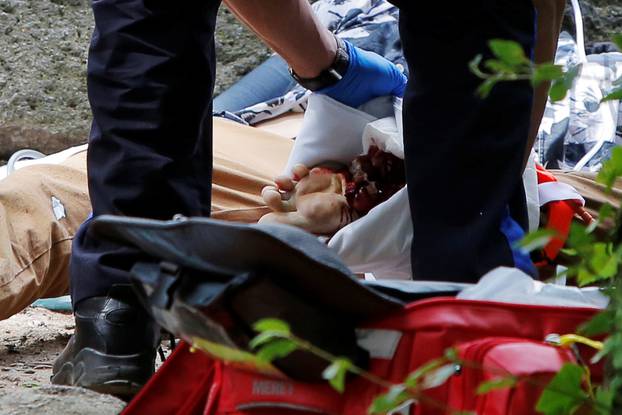 Medics treat the foot of a man who was injured after an explosion in Central Park in Manhattan, New York