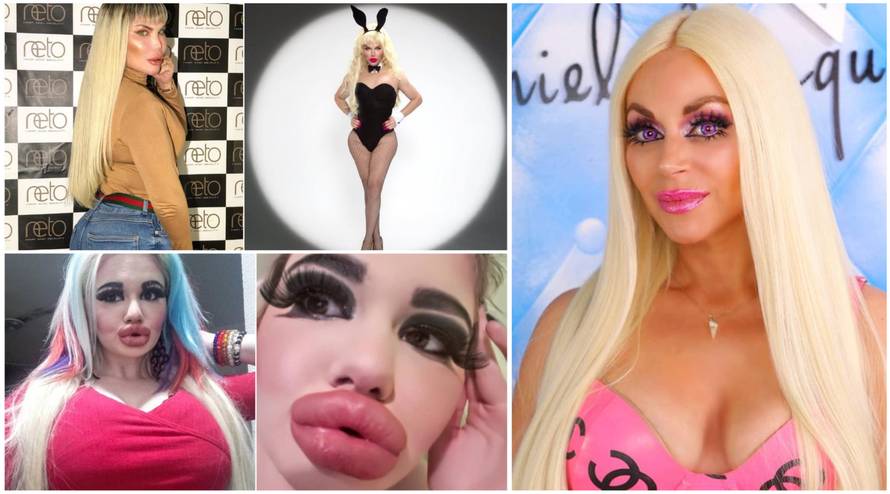 Lutkica zbog koje ljudi idu pod nož: Barbie slavi 61. rođendan