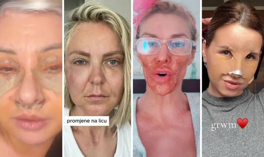 FOTO Ove slavne dame i&scaron;le su pod no&zcaron;: Neke su se 'popravile', druge su imale velikih problema