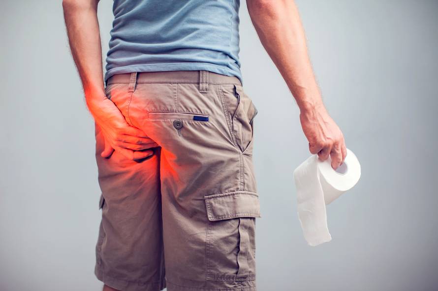 Zašto šutimo o epidemiji hemoroida i bolovima?