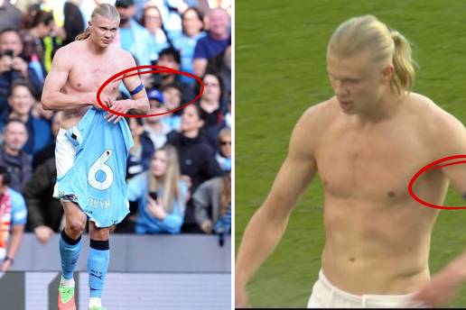 &Scaron;to to Erling Haaland nosi na nadlaktici? Evo u &ccaron;emu je stvar