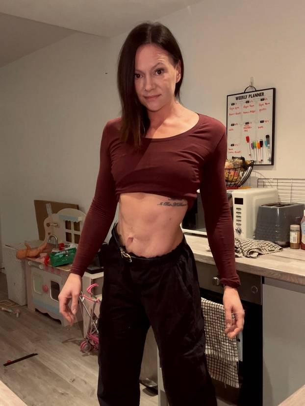 FOTO Smršavjela je gotovo 32 kile u šest mjeseci bez injekcija: Evo kako je to uspjela