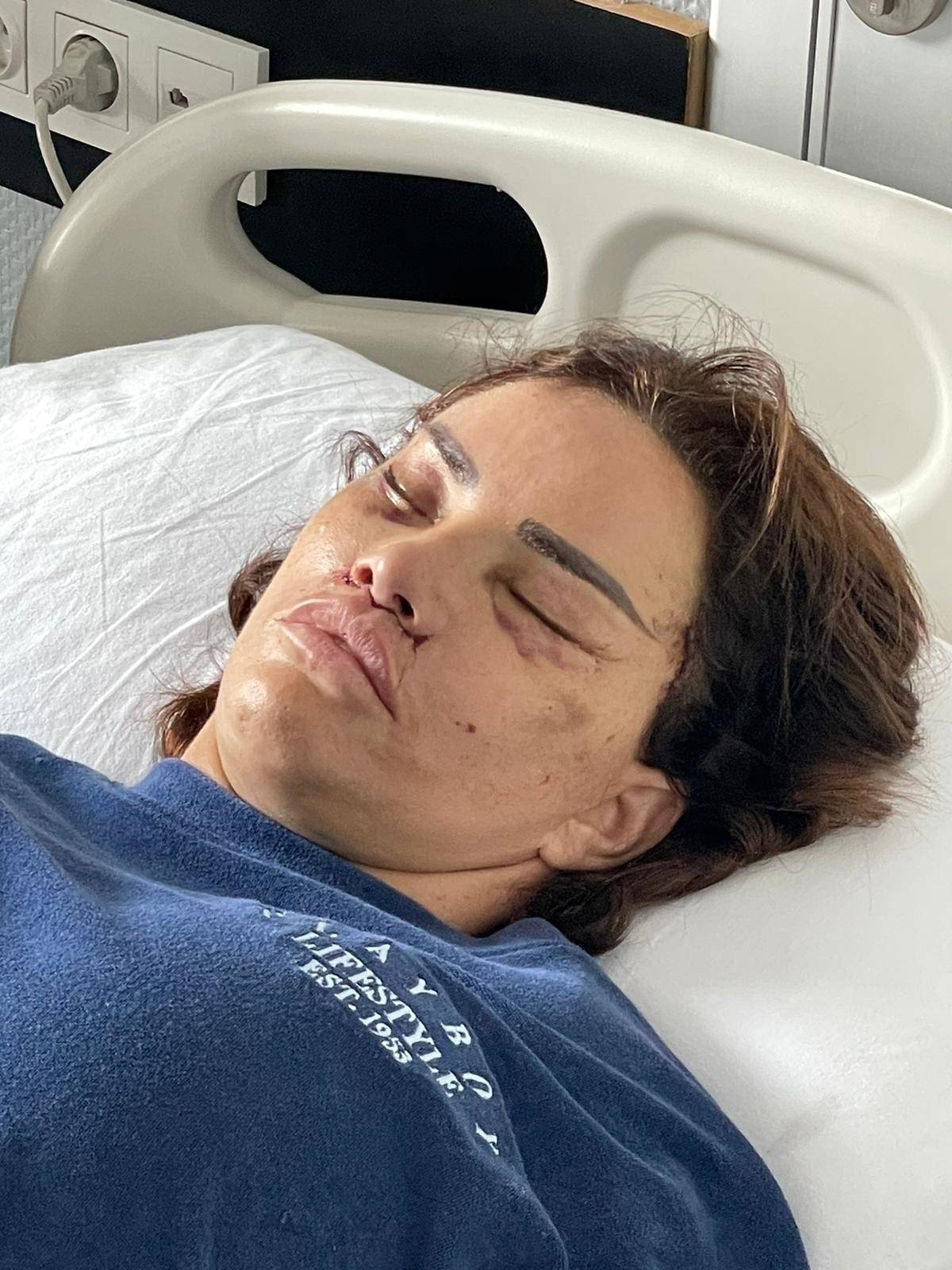 *PREMIUM-EXCLUSIVE* *DO NOT USE UNLESS FEE AGREED* Katie Price goes under the knife yet again in Turkey!