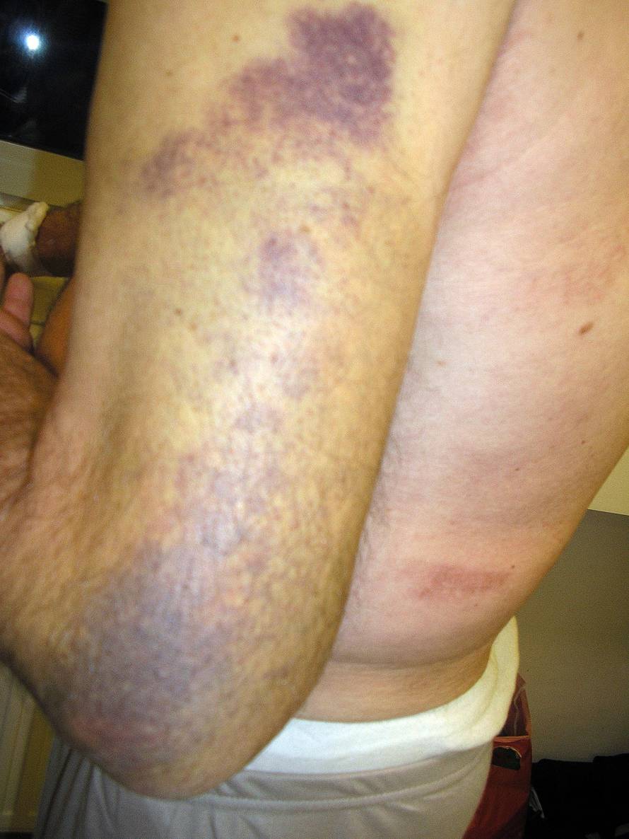 Željko Hladika/24sata