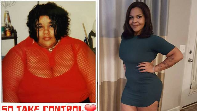 Izgubila je 127 kg: Neznanci joj daju novac za uklanjanje kože