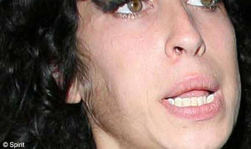 Amy Winehouse ima tijelo 40-godišnjakinje