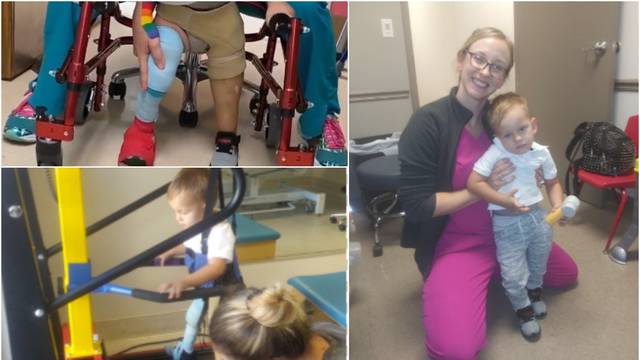 Neopisiva sreća zbog šarene proteze: 'Sad i ja mogu hodati'