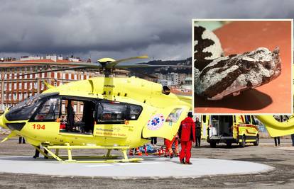 Dječaku kojeg je ugrizao poskok u Istri otkazivali organi. Brzom akcijom liječnici su ga spasili