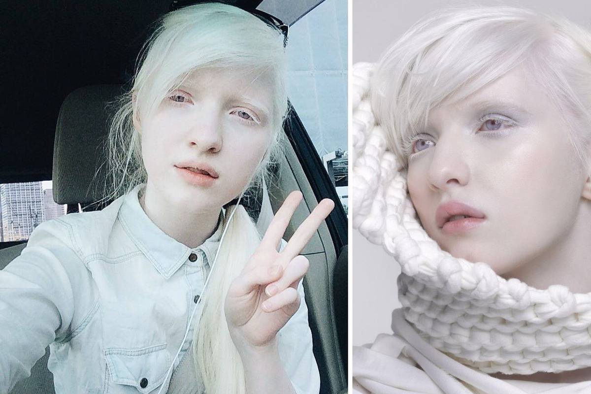 Eterična princeza: Model Nastya Zhidkova najpoznatija je albino djevojka u svijetu manekenstva