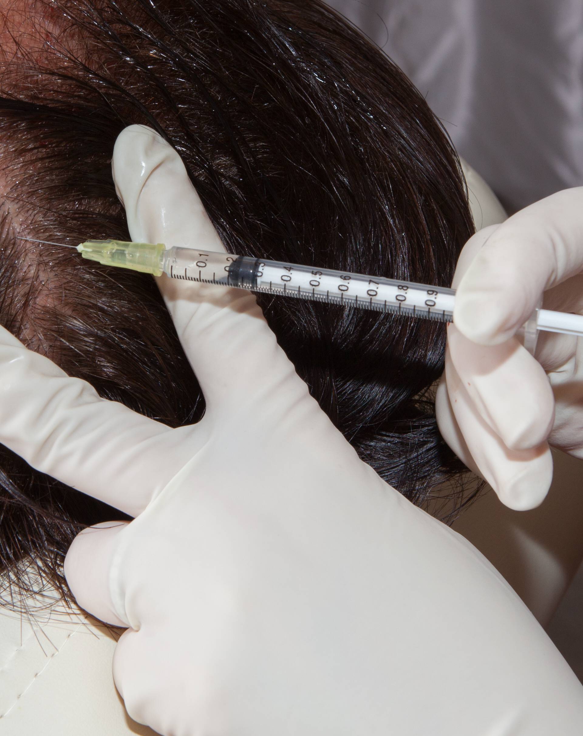 Otkriće za gustu kosu švicarskog dermatologa