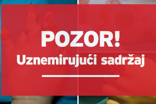 Strašne snimke iz Klaićeve. Evo zašto petarde ne davati djeci: Ostali bez prstiju, šake, vida!