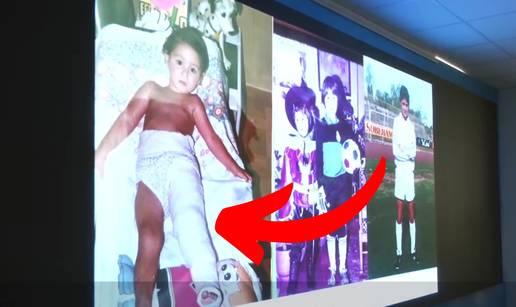 Novi trener Rijeke iznenadio je fotkom iz djetinjstva: 'Rekli su mi da ću šepati do kraja života'