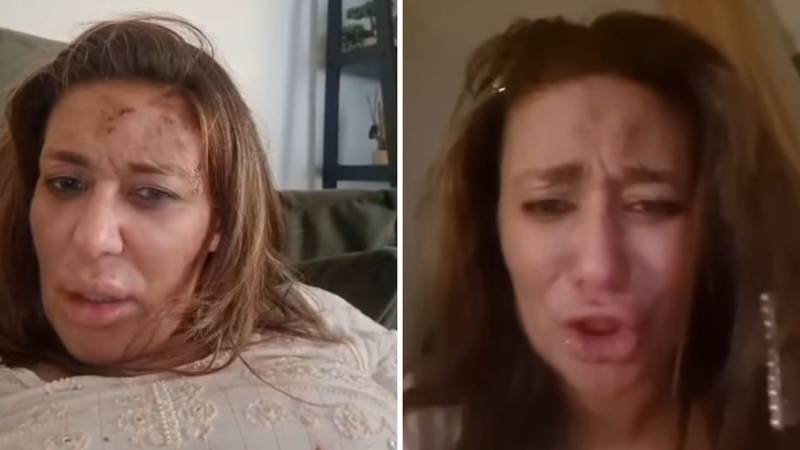 UZNEMIRUJUĆE Pjevačica Ana Nikolić pretučena: Zapomagala u suzama i u krvavoj majici...