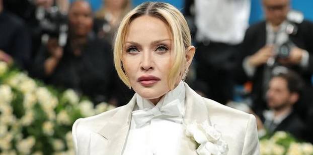 FOTO Zbog operacija postali neprepoznatljivi: Neke zvijezde su 'pod nož' išle čak 300 puta