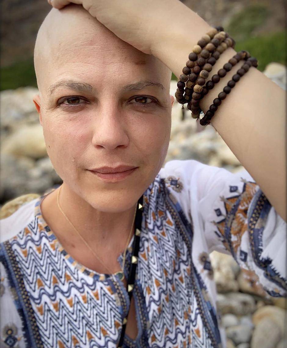 Bolesna glumica o kemoterapiji: 'Bilo me je sram zbog drugih...'