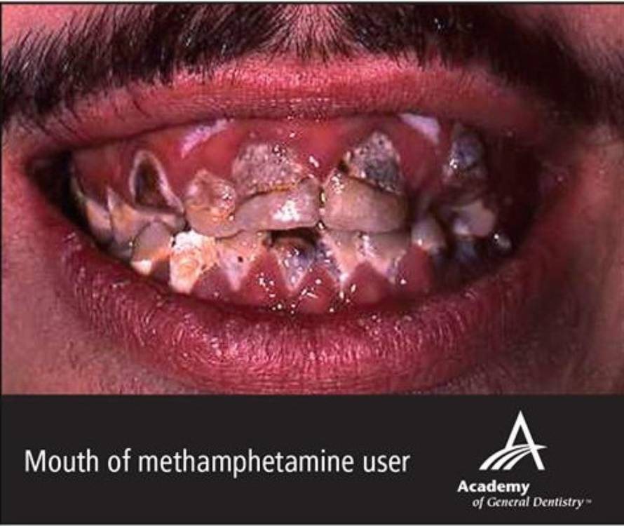 Facebook/Academy of General Dentistry