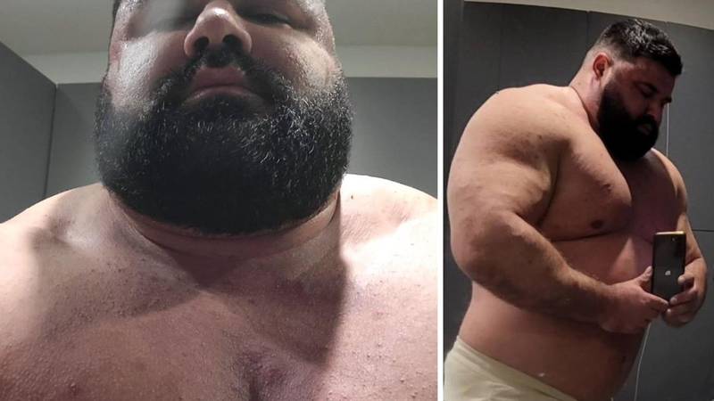FOTO Stručnjaci o Ervinu: Tih 180 kg je previše, vježbao on ili ne, prijete mu mnoge komplikacije