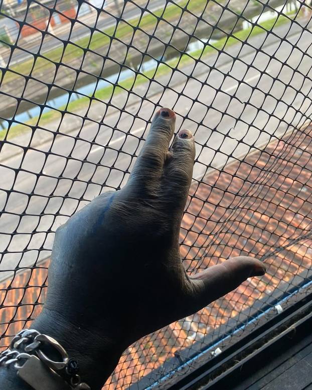 FOTO Uznemirujuće! Uklonila je čak i vrh nosa, a evo kako je izgledala: Šteta, ljepotica si bila