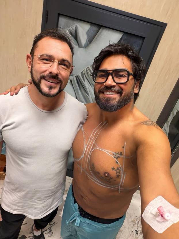 FOTO Ima pjesmu sa Severinom, stavio silikone u prsa, presadio i dlake: Ovako se mijenjao Azis