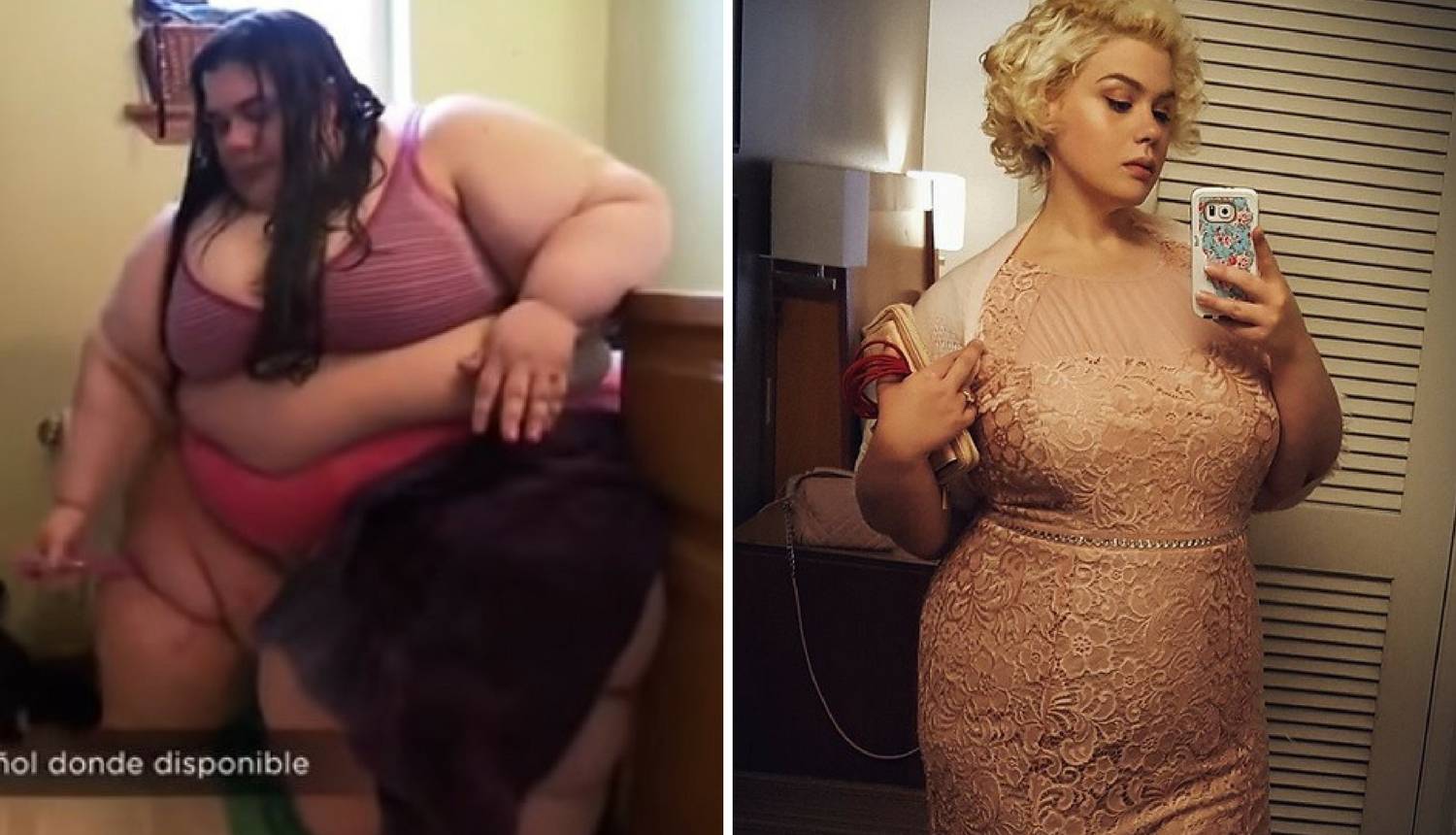 Imala je 300 kg, život joj je bio u opasnosti: Sad je druga žena