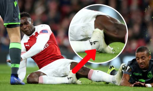 Uznemirujuće! Danny Welbeck slomio nogu, davali mu kisik...