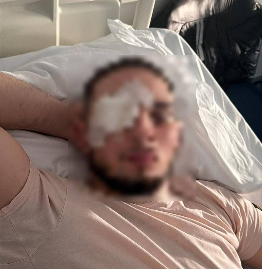 Ispovijest roditelja pretučenog mladića: 'Zaključavamo vrata, bojimo se, a sin je još u šoku...'