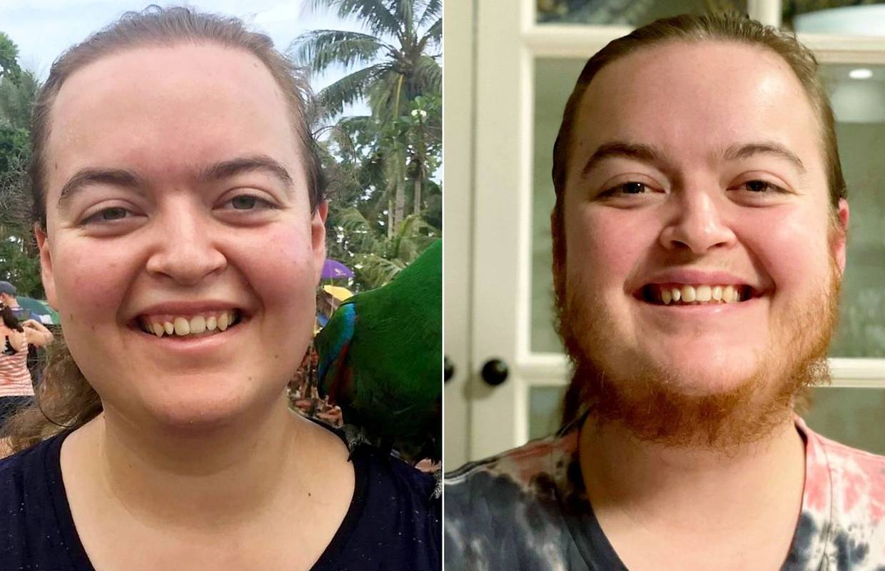 Australka pustila da joj izraste brada: 'Osjećam se slobodnije'